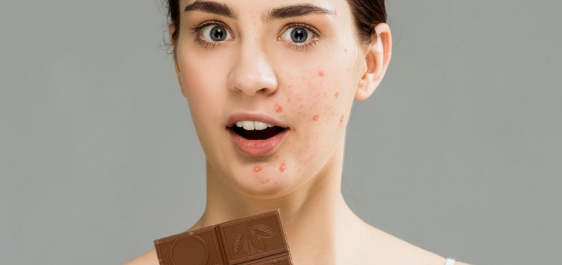 Проблемы на лице: как неправильное питание портит вам кожу